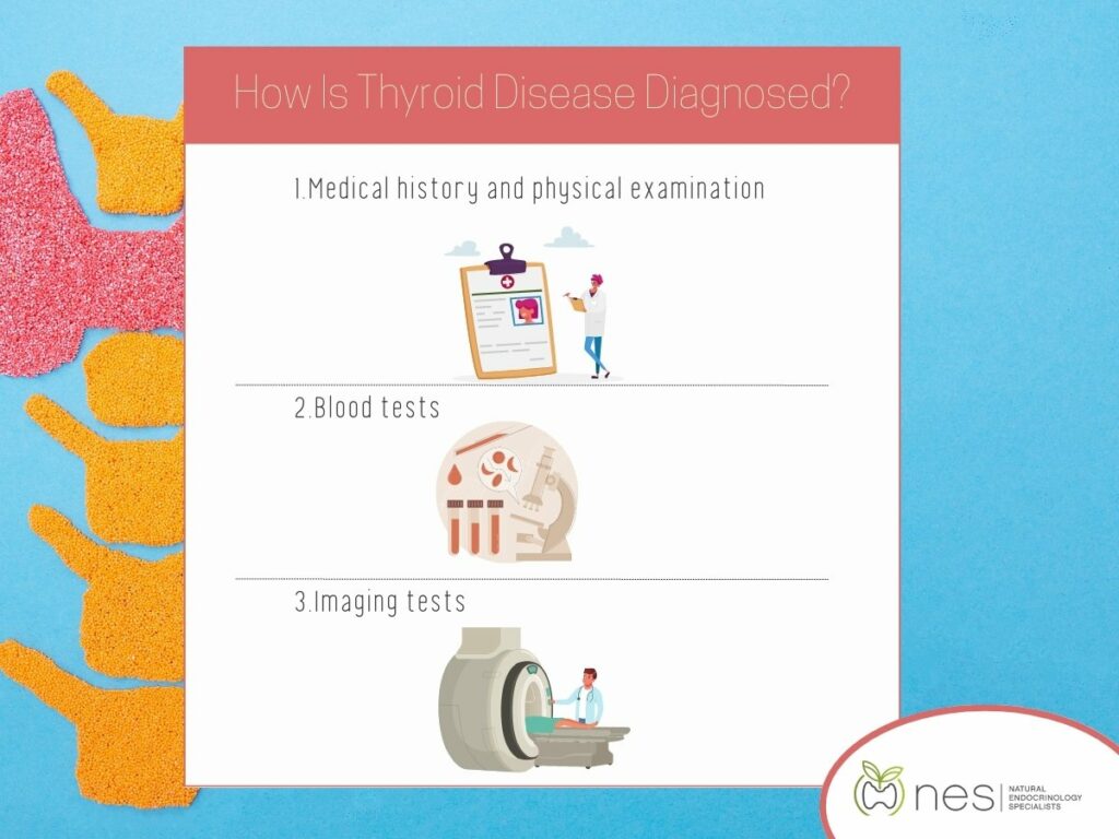 An illustration explaining how thyroid disease is diagnosed for  Pregnacy and thyroid disease
