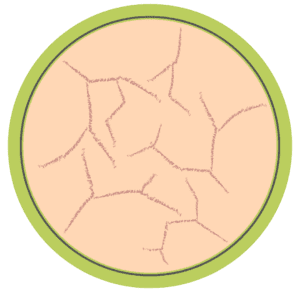 Dry Skin icon on a transparent background