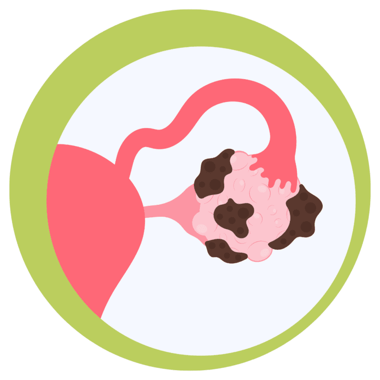 endometriosis on a green circular frame on a white background